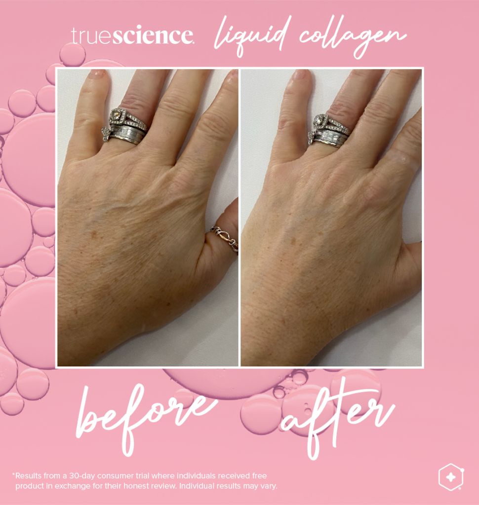 Collagen