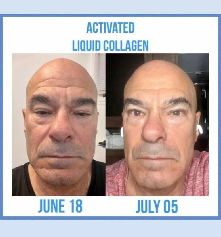 Activated Liquid Collagen